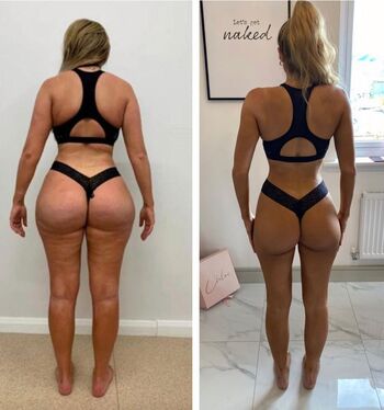 Full leaked Chloe ferry private onlyfans photo