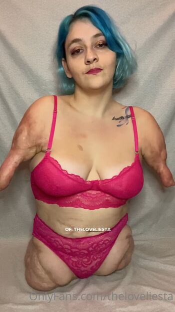 Full leaked Disabled girls page private onlyfans photo