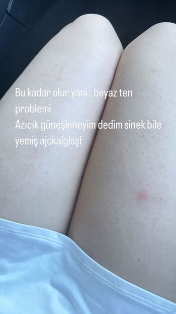 Full leaked Ecbsnn ece basaran private onlyfans photo