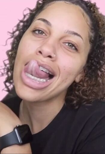 lightskin
