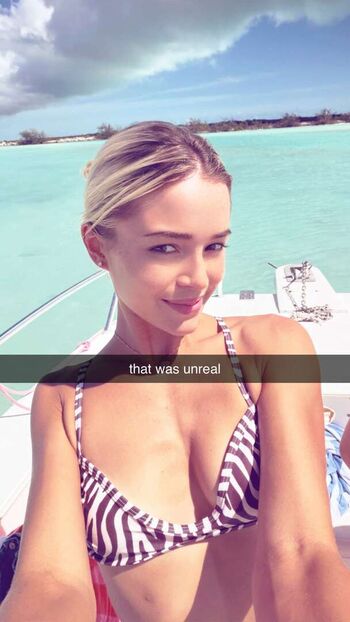 Livvy Dunne
