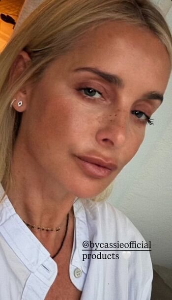 Full leaked Louise redknapp private onlyfans photo