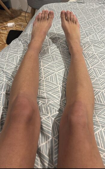 Plantes De Pieds Candid