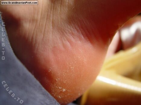 Full leaked Scandinavian feet page private onlyfans photo