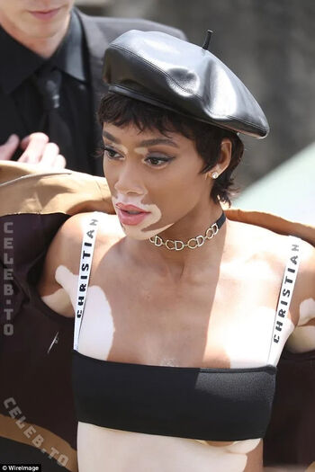 Full leaked Winnie harlow private onlyfans photo
