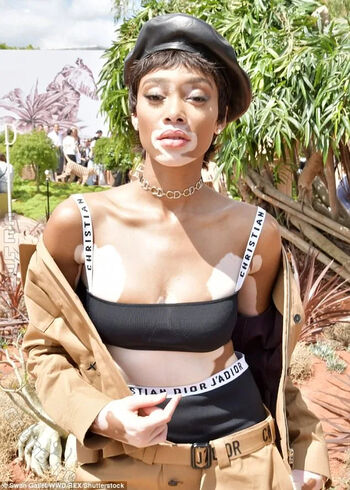Full leaked Winnie harlow private onlyfans photo
