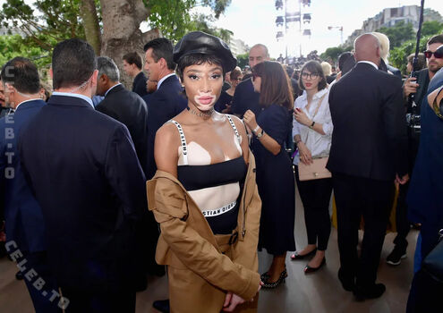 Winnie Harlow