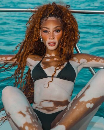 Full leaked Winnie harlow page private onlyfans photo