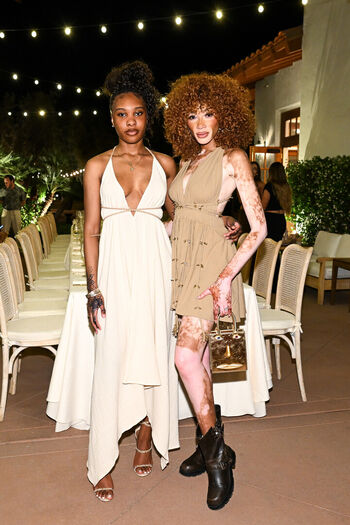 Full leaked Winnie harlow private onlyfans photo